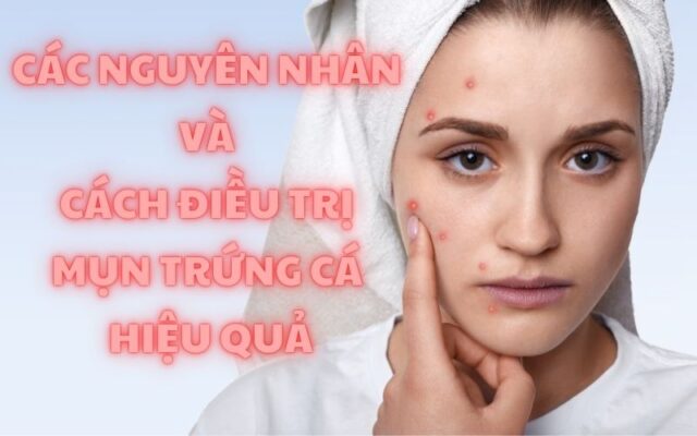 Các nguyên nhân và cách điều trị mụn trứng cá hiệu quả