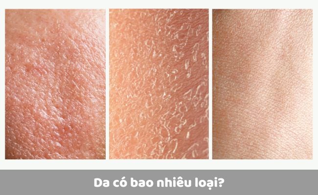 phân biệt các loại da mặt